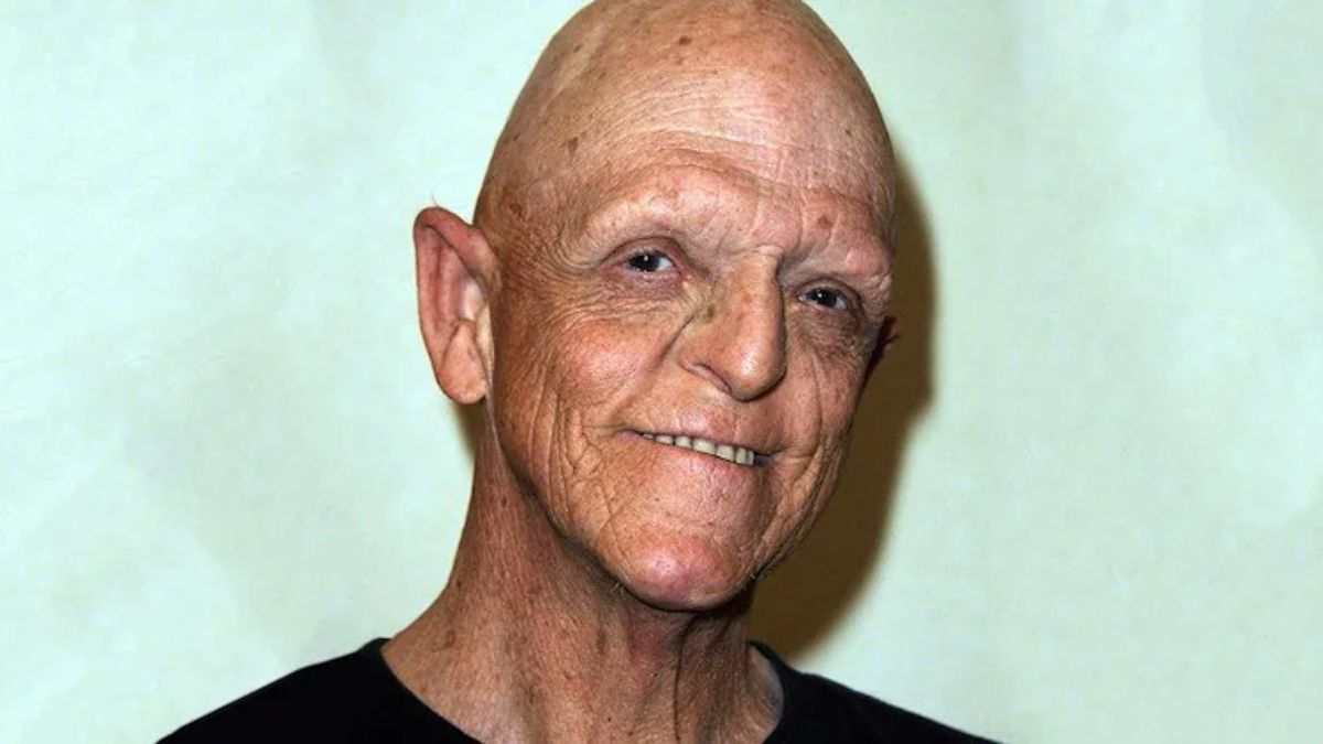 the ugliest person in the world boy